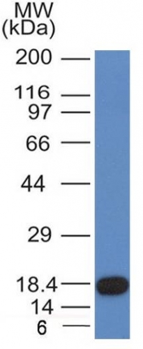 Monoclonal Antibody to CD117 / c-Kit (Marker for Gastrointestinal Stromal Tumors)(Clone : KIT/982)