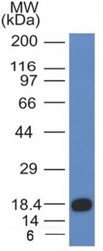 Monoclonal Antibody to CD117 / c-Kit (Marker for Gastrointestinal Stromal Tumors)(Clone : KIT/983)