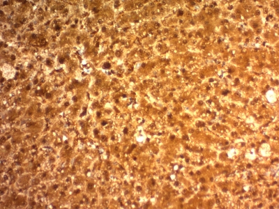 Monoclonal Antibody to Arginase 1 (Hepatocellular Carcinoma Marker)(Clone : ARG1/1126)