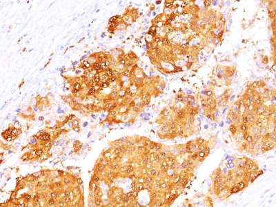 Monoclonal Antibody to Arginase 1 (Hepatocellular Carcinoma Marker)(ARG1/1125 + ARG1/1126)