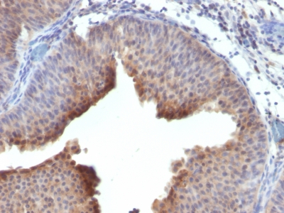 Monoclonal Antibody to Cytokeratin 6 (KRT6) (Hyperproliferation-Related Keratin)(Clone : LHK6; same as LHK6B)(Discontinued)