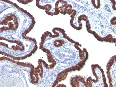 Monoclonal Antibody to Cytokeratin 7 (KRT7) (Glandular and Transitional Epithelial Marker)(Clone : OV-TL12/30