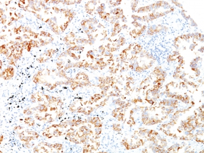 Monoclonal Antibody to Cytokeratin 7 (KRT7) (Glandular and Transitional Epithelial Marker)(Clone : SPM270)