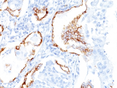 Monoclonal Antibody to Cytokeratin 7 (KRT7) (Glandular and Transitional Epithelial Marker)(Clone : K72.7)