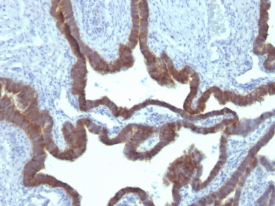 Monoclonal Antibody to Cytokeratin 7 (KRT7) (Glandular and Transitional Epithelial Marker)(Clone : KRT7/903)