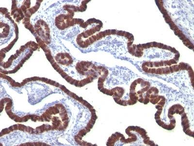 Monoclonal Antibody to Cytokeratin 7 (KRT7) (Glandular and Transitional Epithelial Marker)(Clone : KRT7/760)