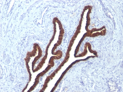 Monoclonal Antibody to Cytokeratin 7 (KRT7) (Glandular and Transitional Epithelial Marker)(KRT7/760 + KRT7/90