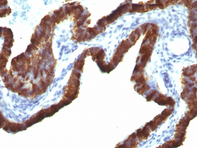 Monoclonal Antibody to Cytokeratin 7 (KRT7) (Glandular and Transitional Epithelial Marker)(KRT7/760 + OV-TL12