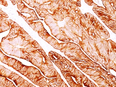 Monoclonal Antibody to Cytokeratin 8 (KRT8)(Clone : H1)(Discontinued)