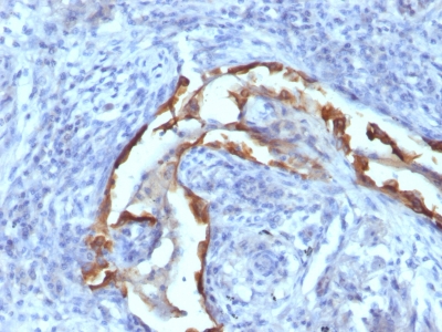 Monoclonal Antibody to Cytokeratin 8 (KRT8)(Clone : SPM538)