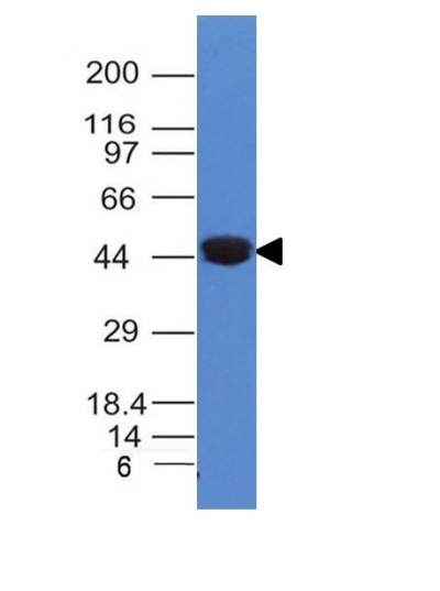 Monoclonal Antibody to Cytokeratin 8 (KRT8)(Clone : K8/383)