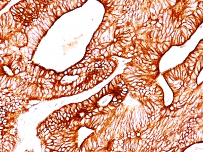 Monoclonal Antibody to Cytokeratin 8 (KRT8)(Clone : TS1)