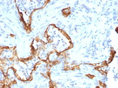 Monoclonal Antibody to Cytokeratin 8 (KRT8)(Clone : SPM192)