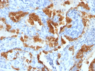 Monoclonal Antibody to Cytokeratin 8 (KRT8)(H1 + TS1)