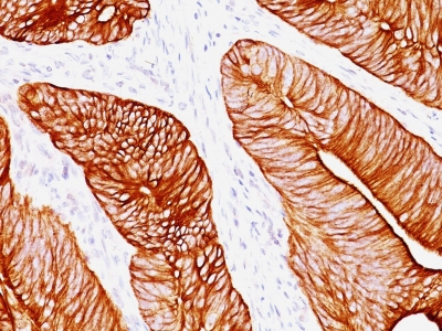 Monoclonal Antibody to Cytokeratin 8 (KRT8)(Clone : K8.8)