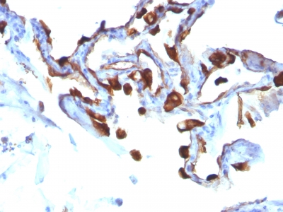 Monoclonal Antibody to Cytokeratin 8 (KRT8)(Clone : KRT8/803)