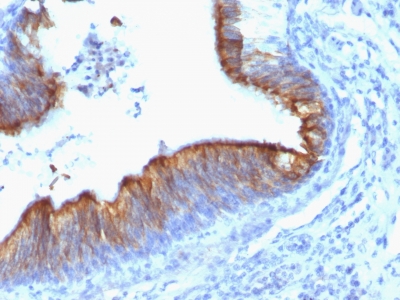 Monoclonal Antibody to Cytokeratin 8 (KRT8)(Clone : KRT8/899)(Discontinued)