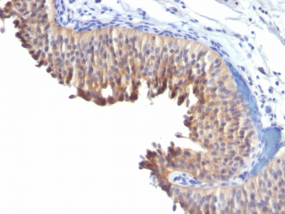 Monoclonal Antibody to Cytokeratin 10 (KRT10) (Suprabasal Epithelial Marker)(Clone : LH2)