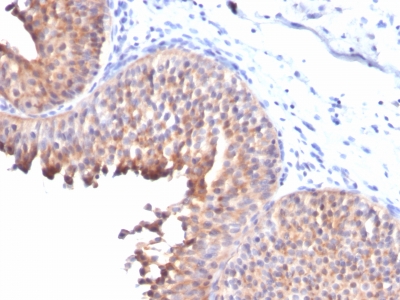 Monoclonal Antibody to Cytokeratin 10 (KRT10) (Suprabasal Epithelial Marker)(Clone : KRT10/844)