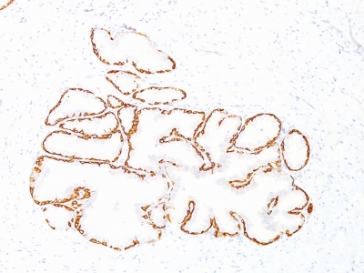 Monoclonal Antibody to Cytokeratin 14 (KRT14) (Squamous Cell Marker)(Clone : SPM263)