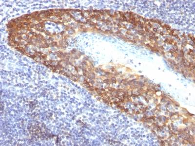 Monoclonal Antibody to Cytokeratin 14 (KRT14) (Squamous Cell Marker)(Clone : KRT14/532)(Discontinued)