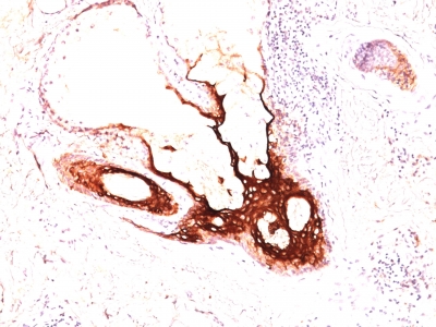 Monoclonal Antibody to Cytokeratin 17 (KRT17) (Basal Epithelial Marker)(Clone : SPM560)