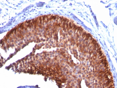 Monoclonal Antibody to Cytokeratin 17 (KRT17) (Basal Epithelial Marker)(Clone : KRT17/778)