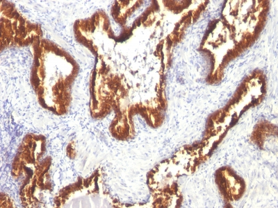 Monoclonal Antibody to Cytokeratin 18 (KRT18)(Clone : KRT18/1190)