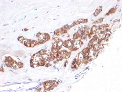 Monoclonal Antibody to Cytokeratin 18 (KRT18)(Clone : SPM510)