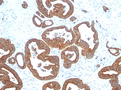 Monoclonal Antibody to Cytokeratin 18 (KRT18)(Clone : DE-K18)