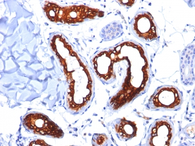 Monoclonal Antibody to Cytokeratin 18 (KRT18)(Clone : KRT18/834)