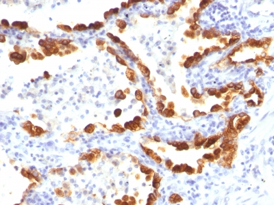 Monoclonal Antibody to Cytokeratin 18 (KRT18)(Clone : KRT18/835)