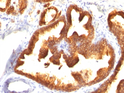 Monoclonal Antibody to Cytokeratin 18 (KRT18)(Clone : KRT18/836)