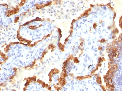 Monoclonal Antibody to Cytokeratin 18 (KRT18)(Clone : Cocktail)