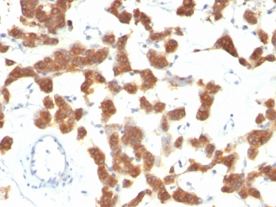 Monoclonal Antibody to Cytokeratin 18 (KRT18)(Clone : B23.1)