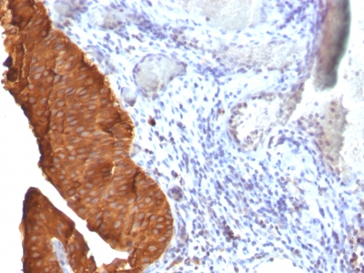 Monoclonal Antibody to Cytokeratin 19 (KRT19) (Pancreatic Stem Cell Marker)(Clone : SPM561)