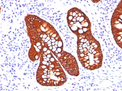 Monoclonal Antibody to Cytokeratin 19 (KRT19) (Pancreatic Stem Cell Marker)(A53-B/A2.26 + BA17)