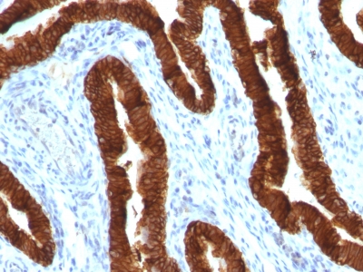 Monoclonal Antibody to Cytokeratin 19 (KRT19) (Pancreatic Stem Cell Marker)(Clone : KRT19/800)