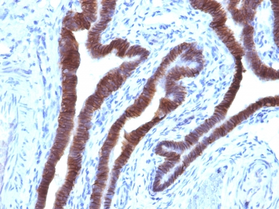 Monoclonal Antibody to Ep-CAM / CD326 (Epithelial Marker)(Clone : EGP40/1110)