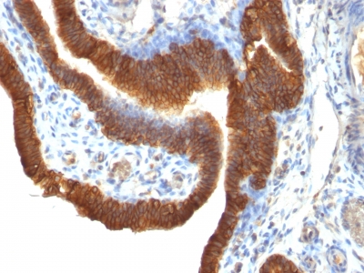 Monoclonal Antibody to Ep-CAM / CD326 (Epithelial Marker)(Clone : SPM491)