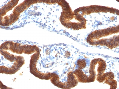 Monoclonal Antibody to Ep-CAM / CD326 (Epithelial Marker)(Clone : SPM134)