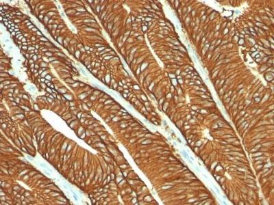 Monoclonal Antibody to Ep-CAM / CD326 (Epithelial Marker)(Clone : MOC-31)