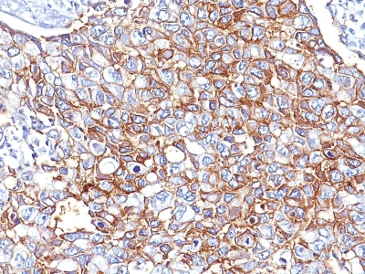 Monoclonal Antibody to Ep-CAM / CD326 (Epithelial Marker)(Clone : EGP40/826)