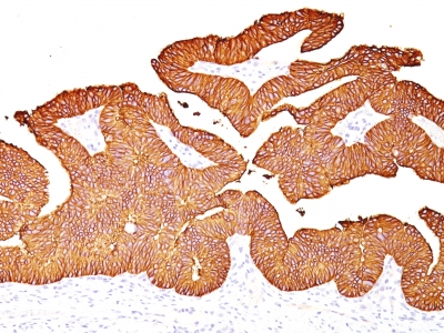 Monoclonal Antibody to Ep-CAM / CD326 (Epithelial Marker)(Clone : EGP40/837)