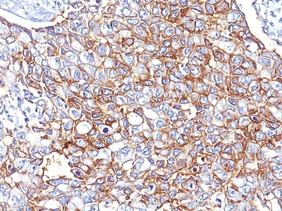 Monoclonal Antibody to Ep-CAM / CD326 (Epithelial Marker)(PAN-EpCAM (Cocktail))