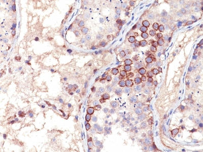 Monoclonal Antibody to MAGE-1 (Target for Cancer Immunotherapy)(Clone : MA454)