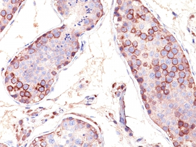 Monoclonal Antibody to MAGE-1 (Target for Cancer Immunotherapy)(Clone : SPM282)