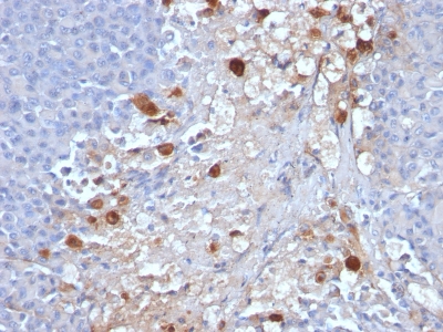 Monoclonal Antibody to MUC18 / CD146 / MCAM (Melanoma Cell Adhesion Molecule)(Clone : MCAM/1101)