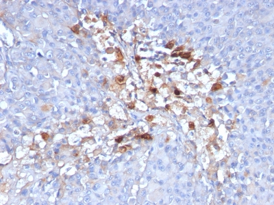 Monoclonal Antibody to MUC18 / CD146 / MCAM (Melanoma Cell Adhesion Molecule)(Clone : C146/634)