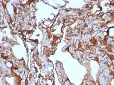 Monoclonal Antibody to MUC18 / CD146 / MCAM (Melanoma Cell Adhesion Molecule)(Clone : MUC18/1130)